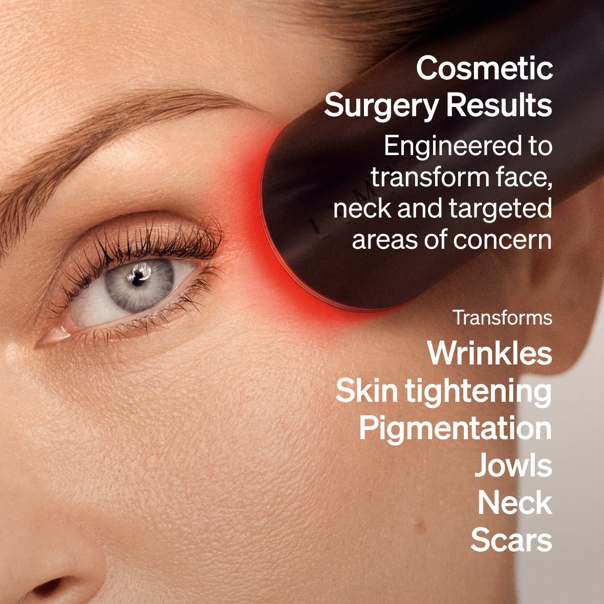 LYMA Laser - Image 2